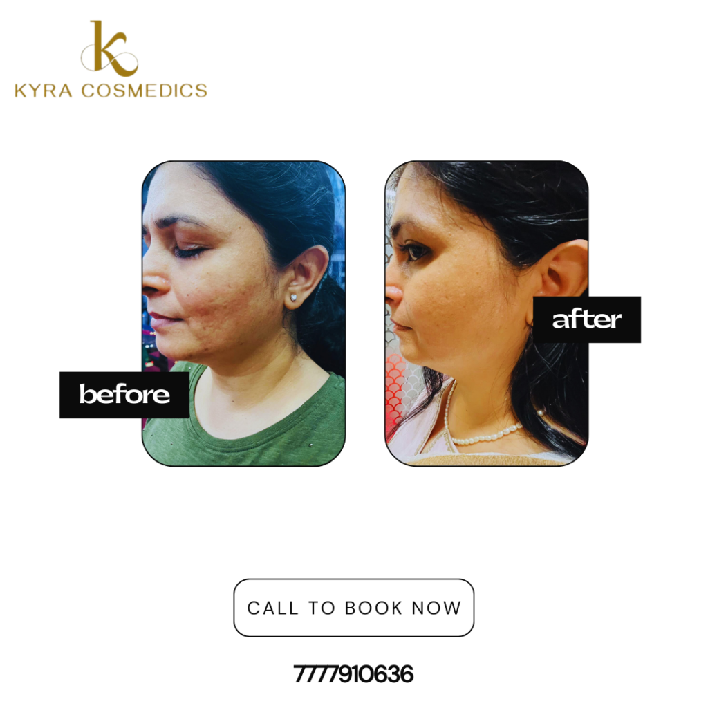 black and gold elegant hair salon instagram post (1)